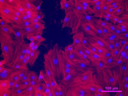 Zum Artikel "Forschungsprojekt: „Tissue/Organ Engineering mit selbst-assemblierenden Proteinen und bioaktiven Biomaterialien: Ein neuer Therapieansatz für die Regenerative Medizin“ als Emerging Field Projekt der FAU in einem Wettbewerbsverfahren ausgewählt und über zwei Jahre gefördert"