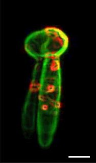 MCF7 bösartiges Zellagregat in 3D Tumor-ähnlicher Mikrokapsel.